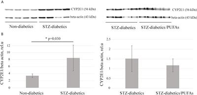 Treatment with omega-3 PUFAs does not increase the risk of CYP2E1-dependent oxidative stress and diabetic liver pathology